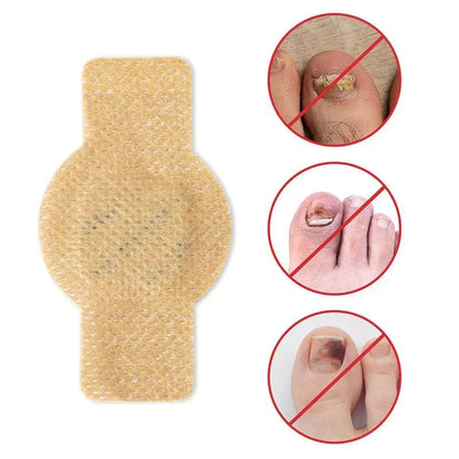 NailRestore – Réparez visiblement vos ongles de l'intérieur