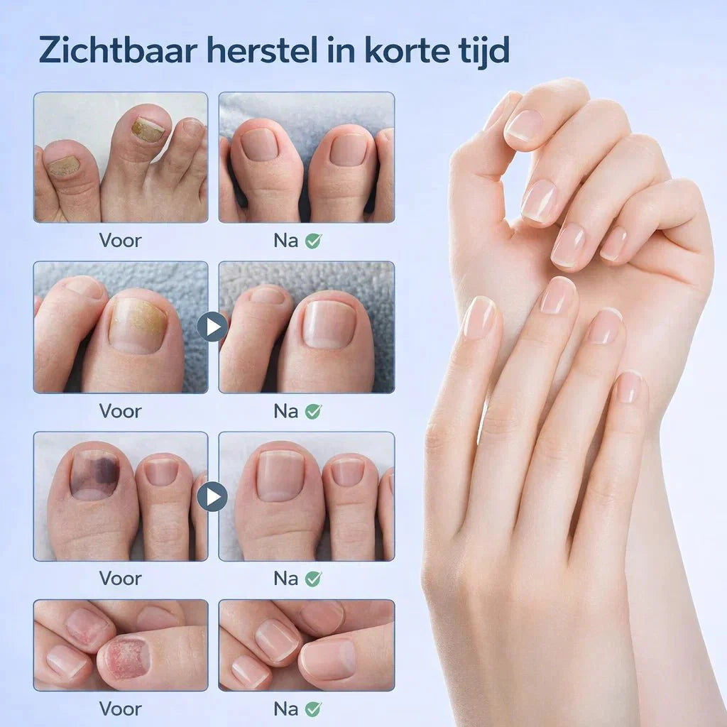 NailRestore – Réparez visiblement vos ongles de l'intérieur
