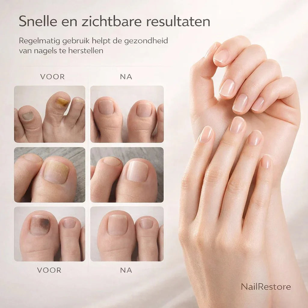 NailRestore – Réparez visiblement vos ongles de l'intérieur