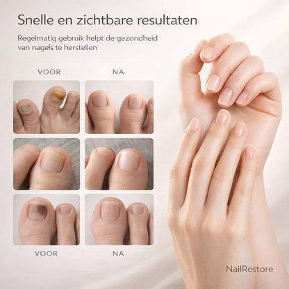 NailRestore – Réparez visiblement vos ongles de l'intérieur