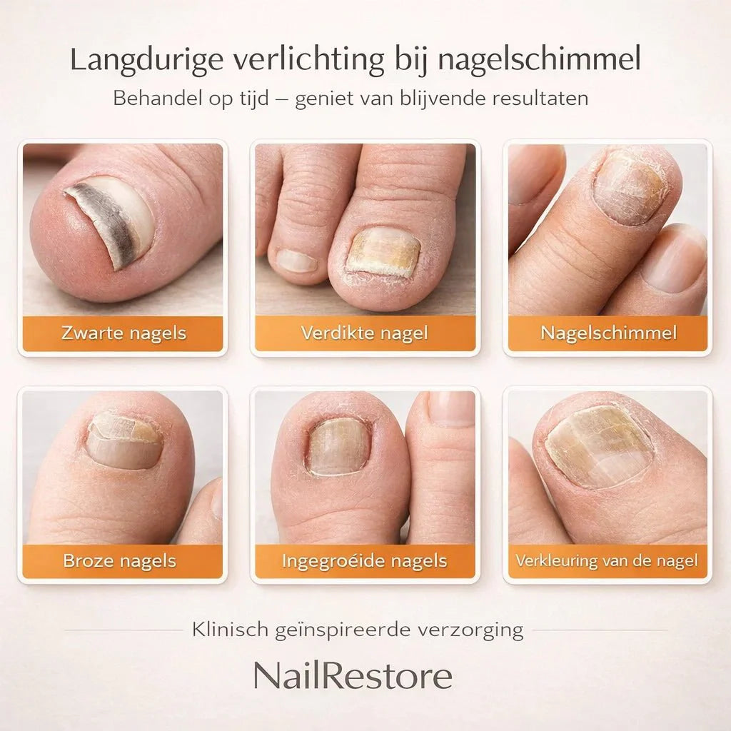 NailRestore – Réparez visiblement vos ongles de l'intérieur