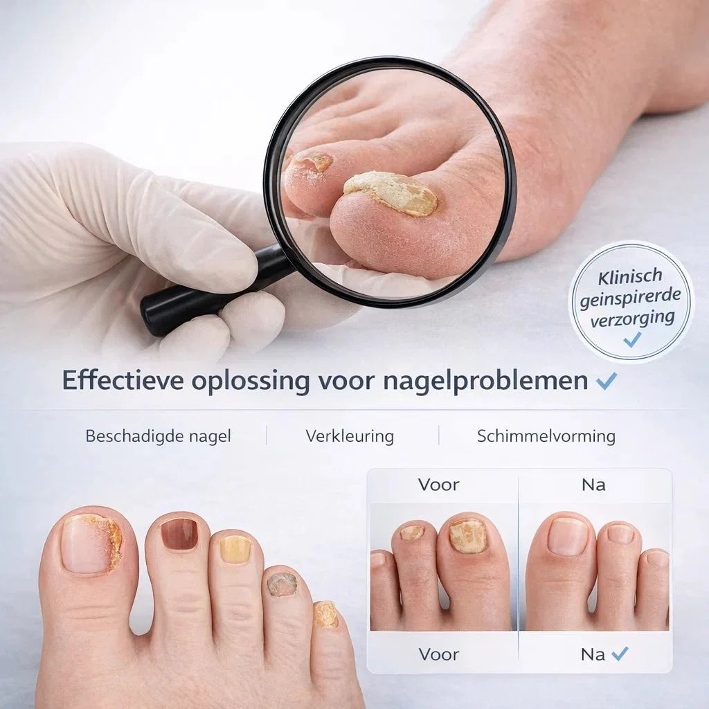 NailRestore – Réparez visiblement vos ongles de l'intérieur